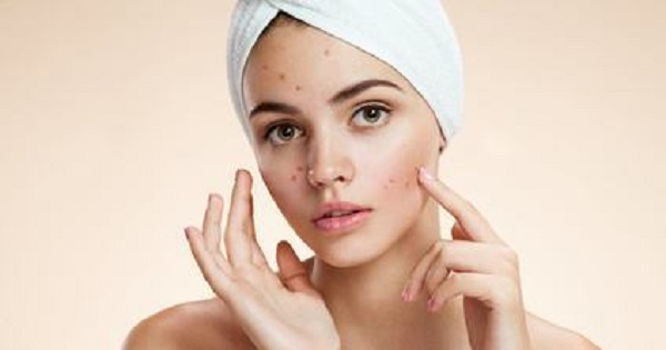 acne-outbreaks-avoid-these-5-common-causes